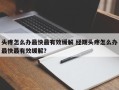 头疼怎么办最快最有效缓解 经期头疼怎么办最快最有效缓解？