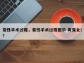 变性手术过程，变性手术过程图示 男变女！？
