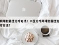 网球肘最佳治疗方法！中医治疗网球肘最佳治疗方法？