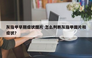 灰指甲早期症状图片 怎么判断灰指甲图片和症状？