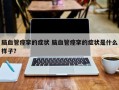 脑血管痉挛的症状 脑血管痉挛的症状是什么样子？