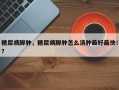糖尿病脚肿，糖尿病脚肿怎么消肿最好最快！？